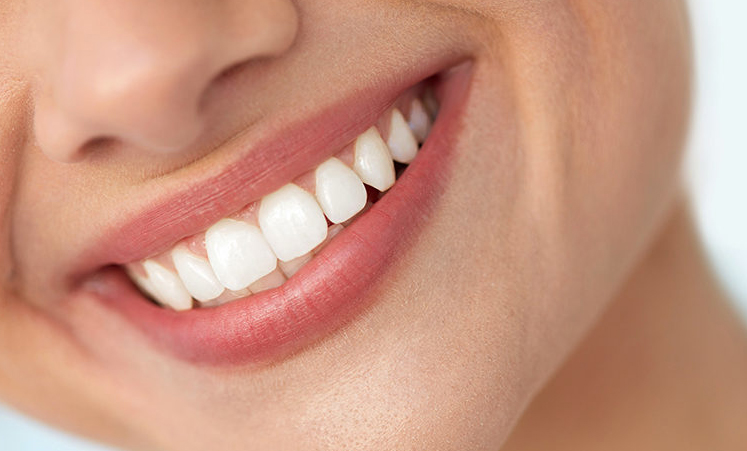 Cosmetic Dentistry Teeth Bonding