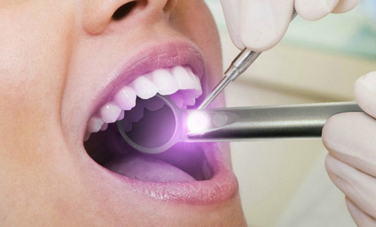 Preventative Dentistry - Oral Cancer Screening