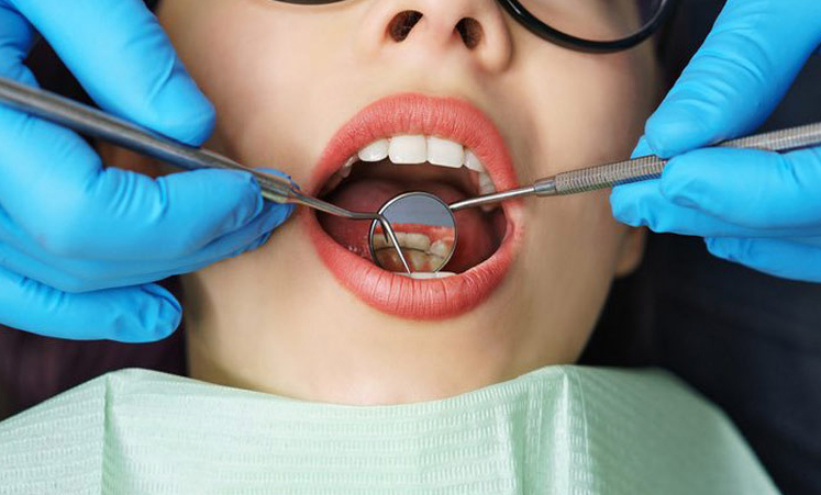 Preventative Dental Services