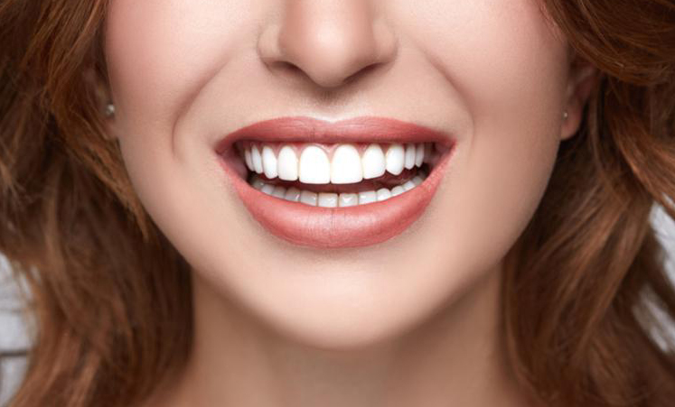 Smile Design - Cosmetic Dentistry