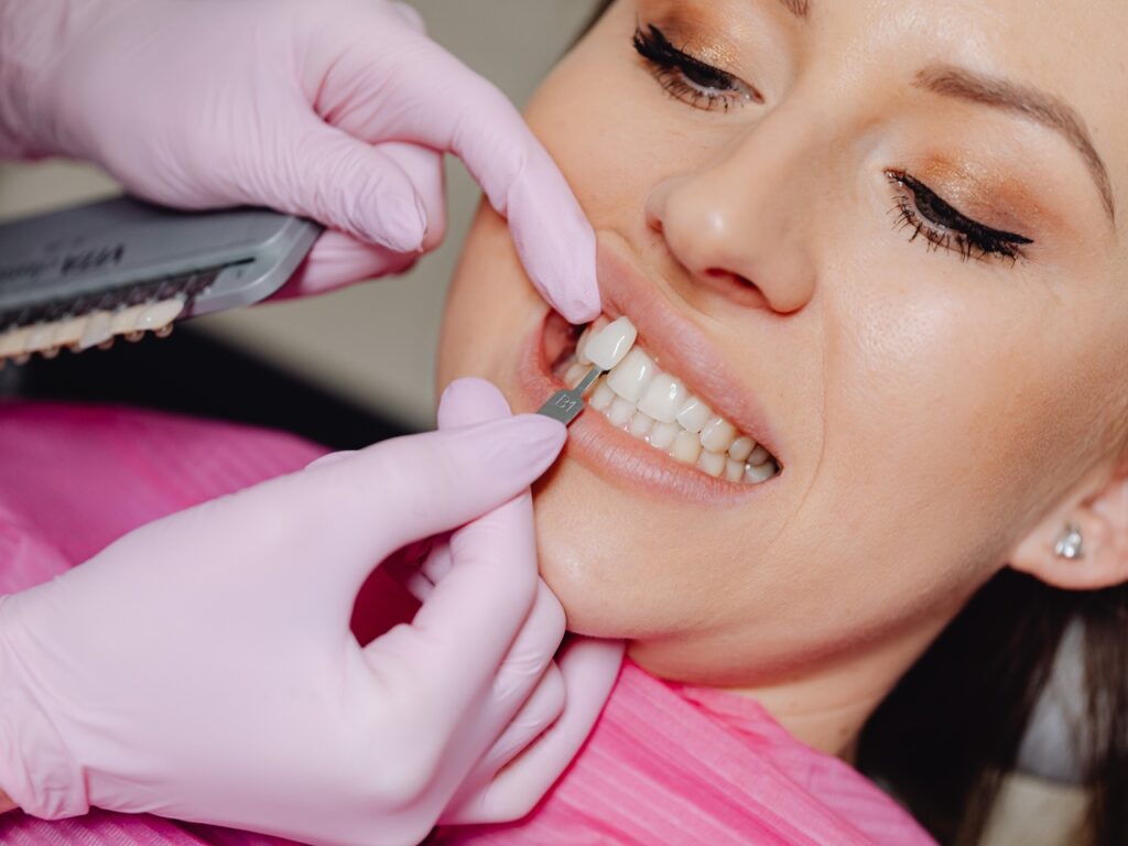 Professional Teeth Whitening Elevates Your Smile — McClane Dentistry