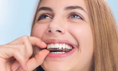 Professional Teeth Whitening Elevates Your Smile — McClane Dentistry