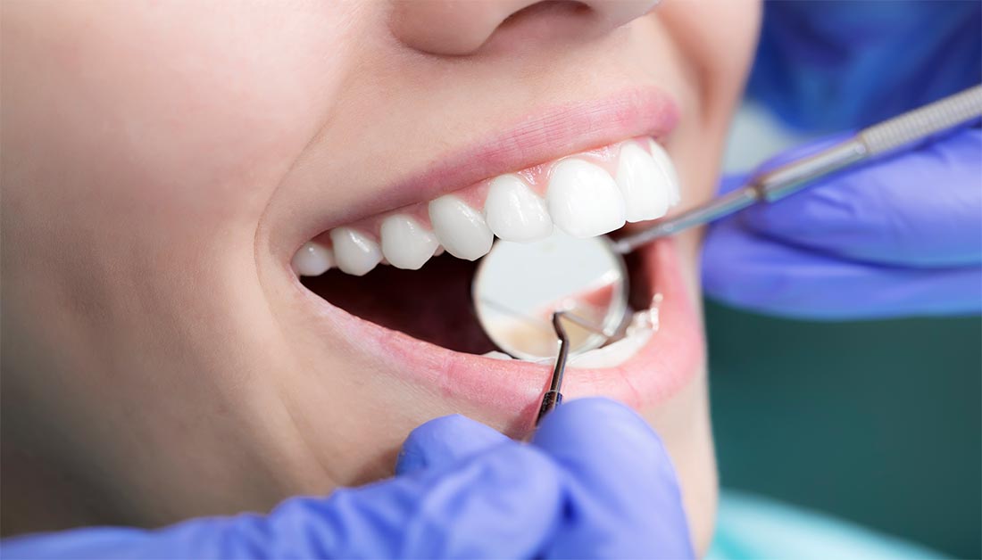 Replace a Missing Tooth with a Single Tooth Implant at McClane Dentistry