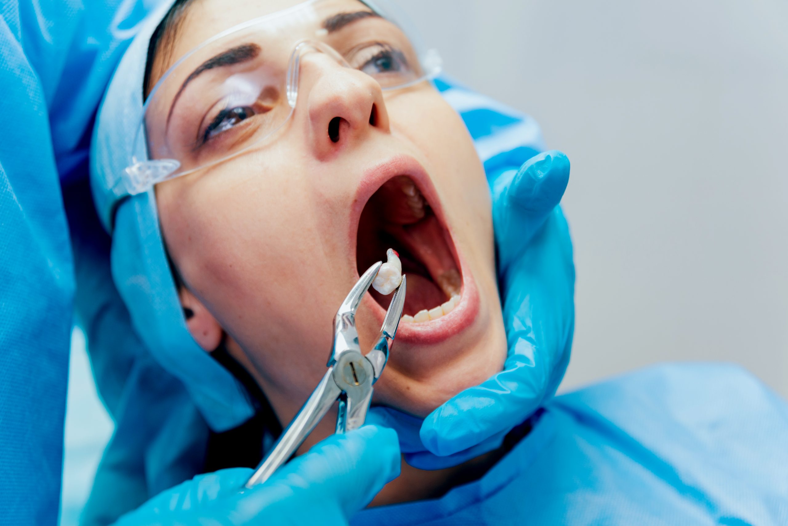 tooth-extraction-solutions-for-comfort Tooth Extraction Solutions at McClane Dentistry
