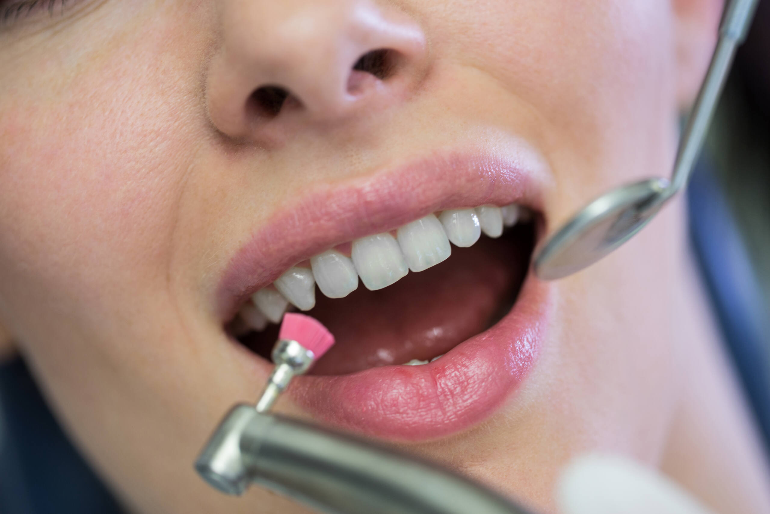 Gum Recession Repair in Stuart Florida at McClane Dentistry