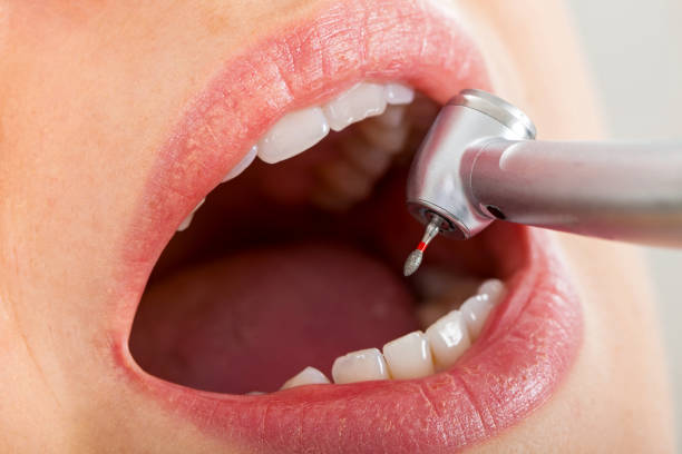 Toothache Emergency Dentistry at McClane Dentistry in Stuart, FL