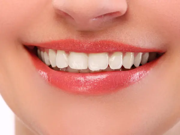 Teeth-Whitening-1.jpg Toothache Emergency Dentistry at McClane Dentistry in Stuart, FL
