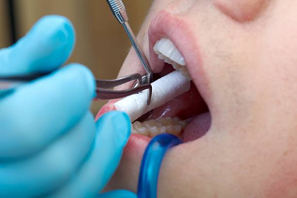 The dentist drill the tooth with a turbine Soft Tissue Injury Treatment at McClane Dentistry in Stuart, FL